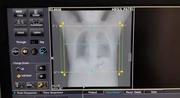 MRI scan price full body Nagpur